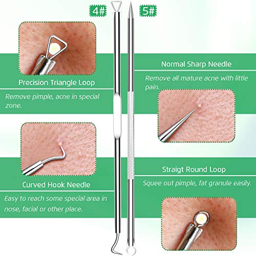 5PCS Blackhead Remover Comedone Extractor, Curved Blackhead Tweezers Kit, Professional Stainless Pimple Acne Blemish Removal Tools Kit - Morena Vogue