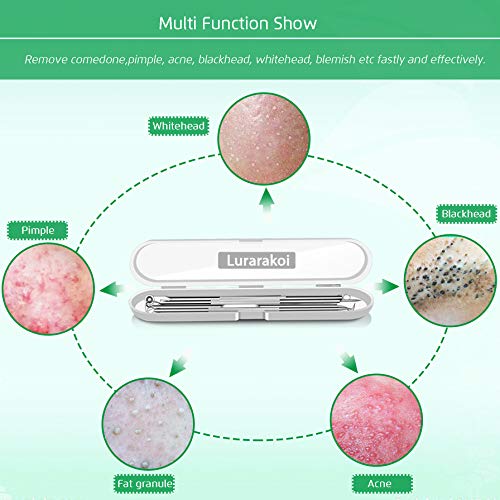 5PCS Blackhead Remover Comedone Extractor, Curved Blackhead Tweezers Kit, Professional Stainless Pimple Acne Blemish Removal Tools Kit - Morena Vogue