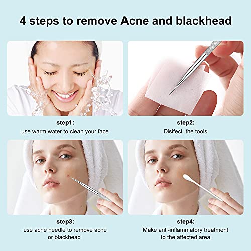 Blackhead Remover, 2 PCS Pimple Popper ，Stainless Steel Pimple Extractor Blackhead Removal Tool Risk Free Treatment for Blemish,Whitehead Popping - Morena Vogue