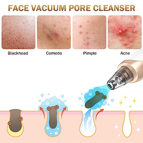 Blackhead Remover Pore Vacuum Kit - 2023 Upgraded Blackhead Extractor Tool with 3 Adjustable Suction Levels, 5 Probes, USB Rechargeable, Suitable for Women and Men - Morena Vogue