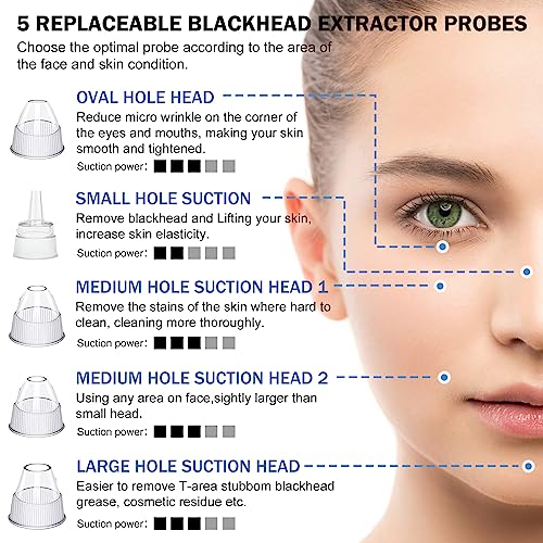 Blackhead Remover Pore Vacuum Kit - 2023 Upgraded Blackhead Extractor Tool with 3 Adjustable Suction Levels, 5 Probes, USB Rechargeable, Suitable for Women and Men - Morena Vogue