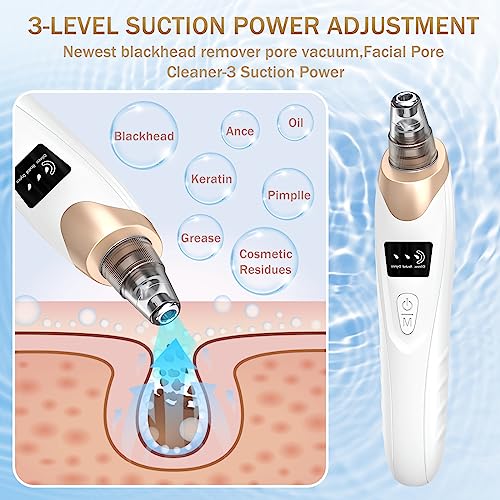 Blackhead Remover Pore Vacuum Kit - 2023 Upgraded Blackhead Extractor Tool with 3 Adjustable Suction Levels, 5 Probes, USB Rechargeable, Suitable for Women and Men - Morena Vogue