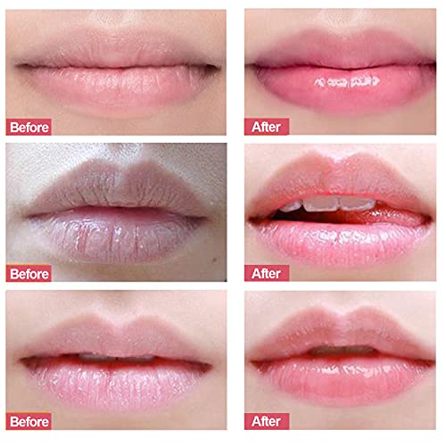 Blue Finger Lip Scrub, Lip Sleeping Mask, Lip Treatment,Peach Overnight Moisturizing Repairing Lips Mask, Sleeping Lip Balm, Peeling Lips, Lip Primer, Chapped Skin (Peach) - Morena Vogue