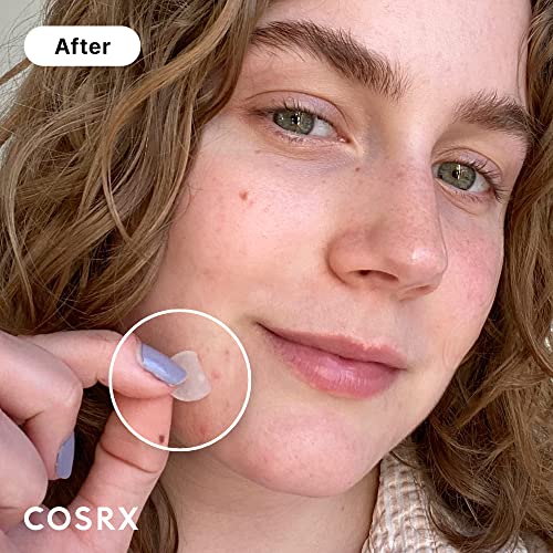 COSRX Acne Pimple Patch (96 Count) Absorbing Hydrocolloid Spot Treatment Fast Healing, Blemish Cover, Three Sizes - Morena Vogue