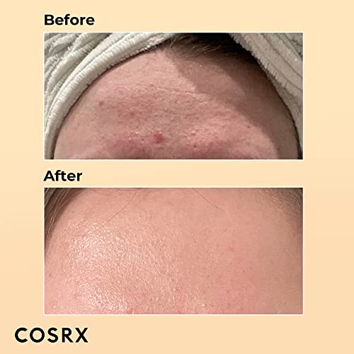 COSRX Snail Mucin 96% Power Repairing Essence 3.38 fl.oz 100ml, Hydrating Serum for Face with Snail Secretion Filtrate for Dull Skin & Fine Lines, Korean Skincare - Morena Vogue