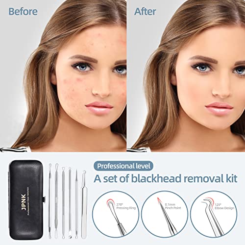 JPNK Blackhead Remover Tool Comedones Extractor Acne Removal Kit for Blemish, Whitehead Popping, 6 Pcs Zit Removing for Nose Face Tools with a Leather Bag - Morena Vogue