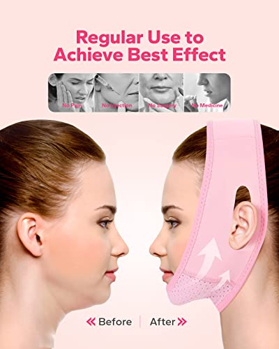 Meto Reusable Face Strap, V Line Mask, Double Chin Reducer, Chin Up Patch, Chin Strap, V Shaped Belt, V Shaped Face Mask for Sagging - Morena Vogue