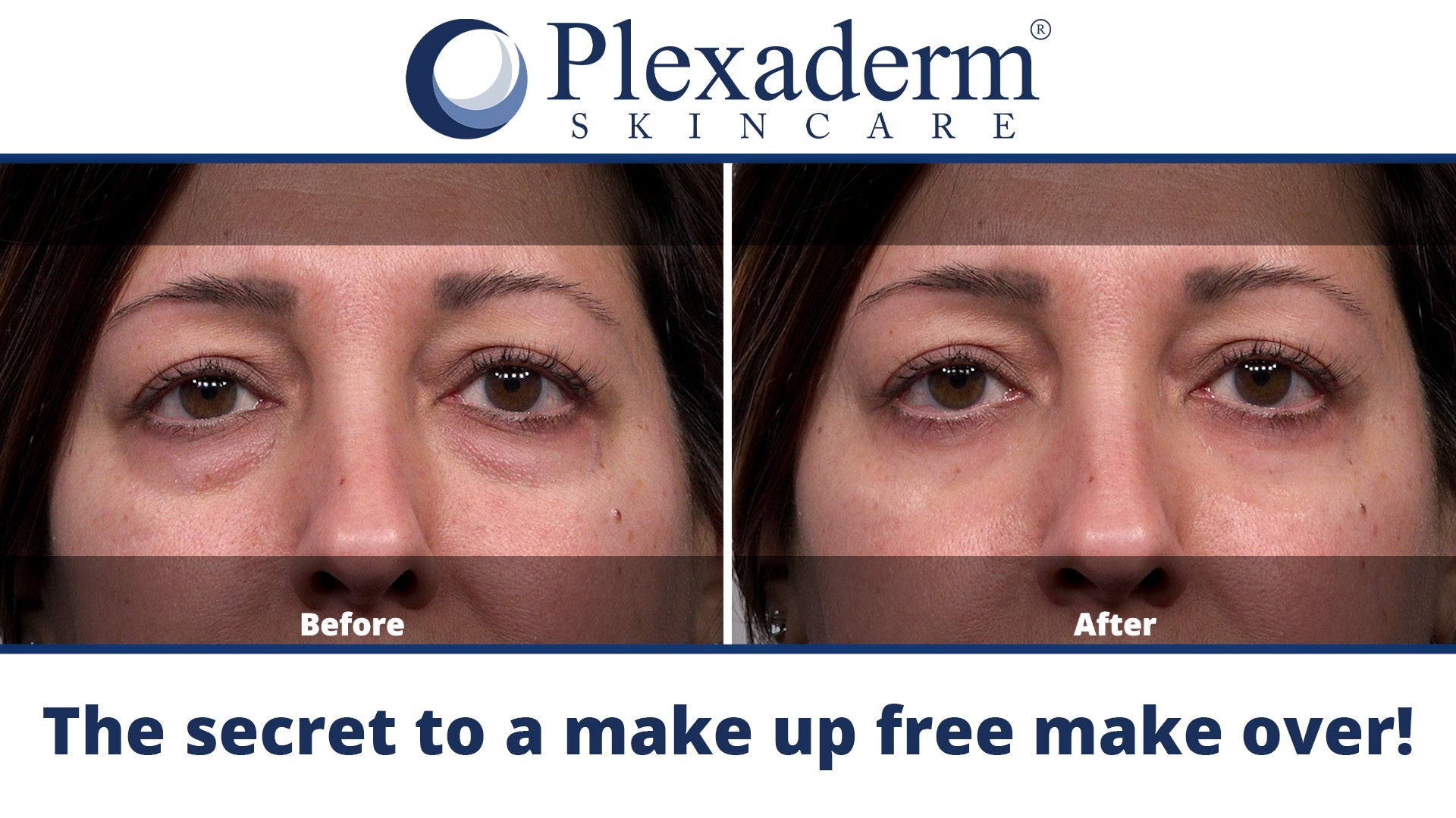 Plexaderm Rapid Reduction Eye Serum - Advanced Formula Anti Aging Visibly Reduces Under-Eye Bags, Wrinkles, Dark Circles, Fine Lines & Crow's Feet Instantly Instant Wrinkle Remover for Face - Morena Vogue