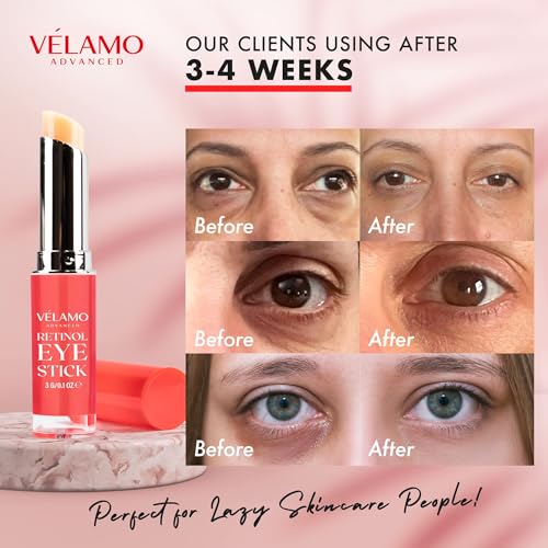 Retinol Eye Stick, Retinol Eye Cream, Retinol Cream, Retinol Face Cream, Under Eye Cream Anti Aging, Eye Cream, Brightening Eye Balm Reduces Fine Lines and Dark Circles, Visible Results in 3-4 Weeks - Morena Vogue