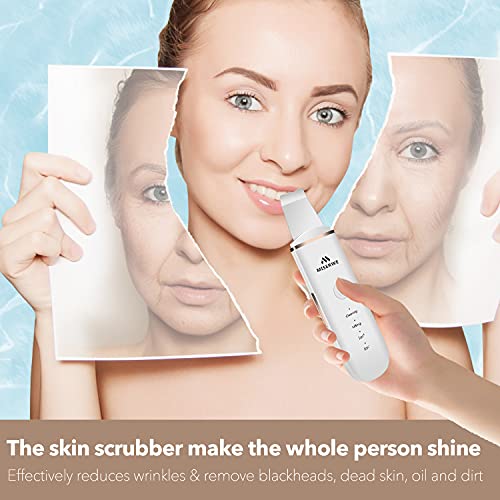 Skin Scrubber Face Skin Spatula Facial Scrubber Spatula for Deep Cleansing Blackhead Remover Pore Cleaner with 4 Modes (White) - Morena Vogue