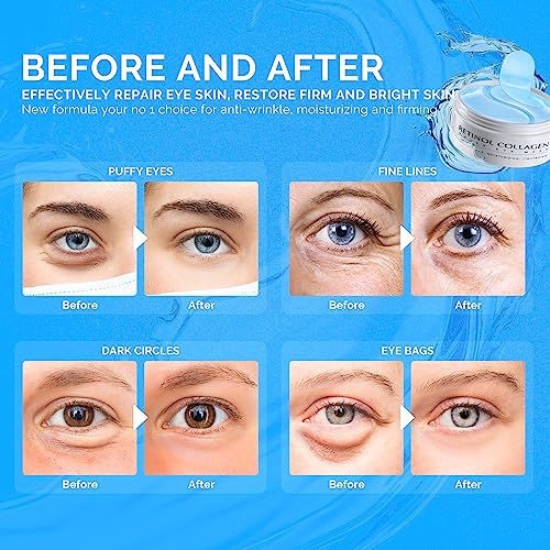 Under Eye Patches for Dark Circles: 30 Pairs Enaskin Naturals Retinol Collagen Eye Gels Mask - Reduce Wrinkles Puffy & Bags - Skin Treatment Pads - Anti Aging Moisturizer For Women Gift (Blue) - Morena Vogue