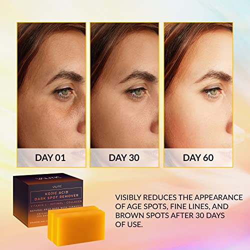 VALITIC Kojic Acid Dark Spot Remover Soap Bars with Vitamin C, Retinol, Collagen, Turmeric - Original Japanese Complex Infused with Hyaluronic Acid, Vitamin E, Shea Butter, Castile Olive Oil (2 Pack) - Morena Vogue